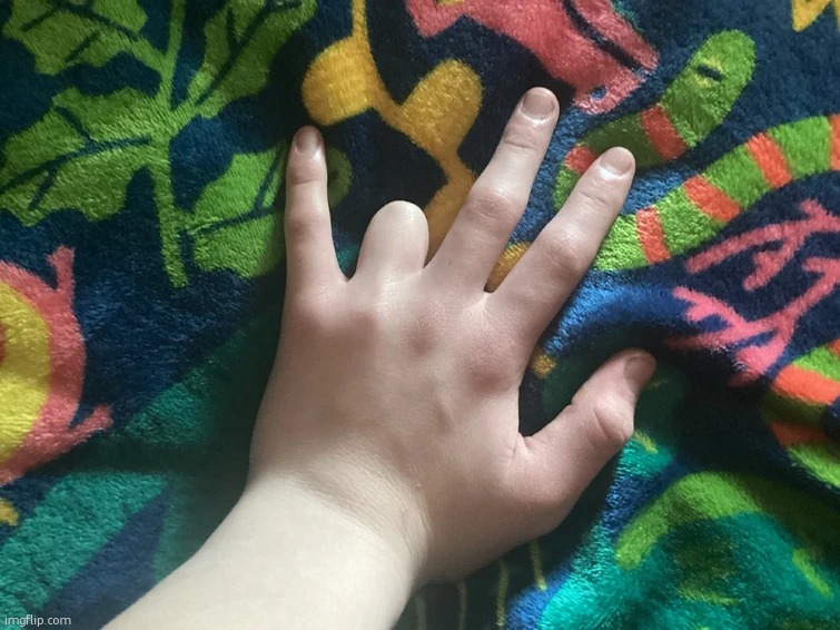 Toady uploaded a template of her hand. Ofcourse she lies every time she get | image tagged in toadythetoads fat hand | made w/ Imgflip meme maker