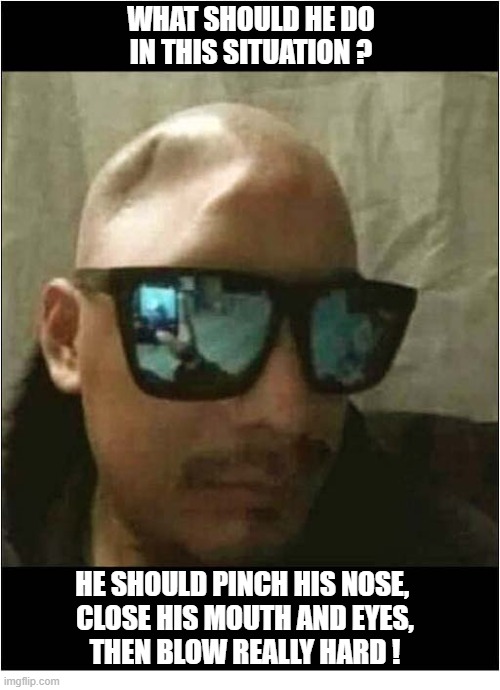 Urgent Help Required ! | What should he do
in this situation ? he should pinch his nose, 
close his mouth and eyes,
 then Blow Really Hard ! | image tagged in help,head,dented,blow up | made w/ Imgflip meme maker