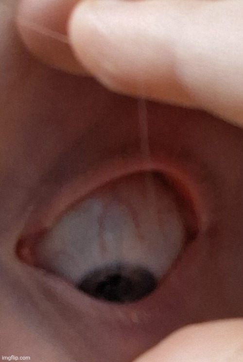 Eye vein reveal | made w/ Imgflip meme maker