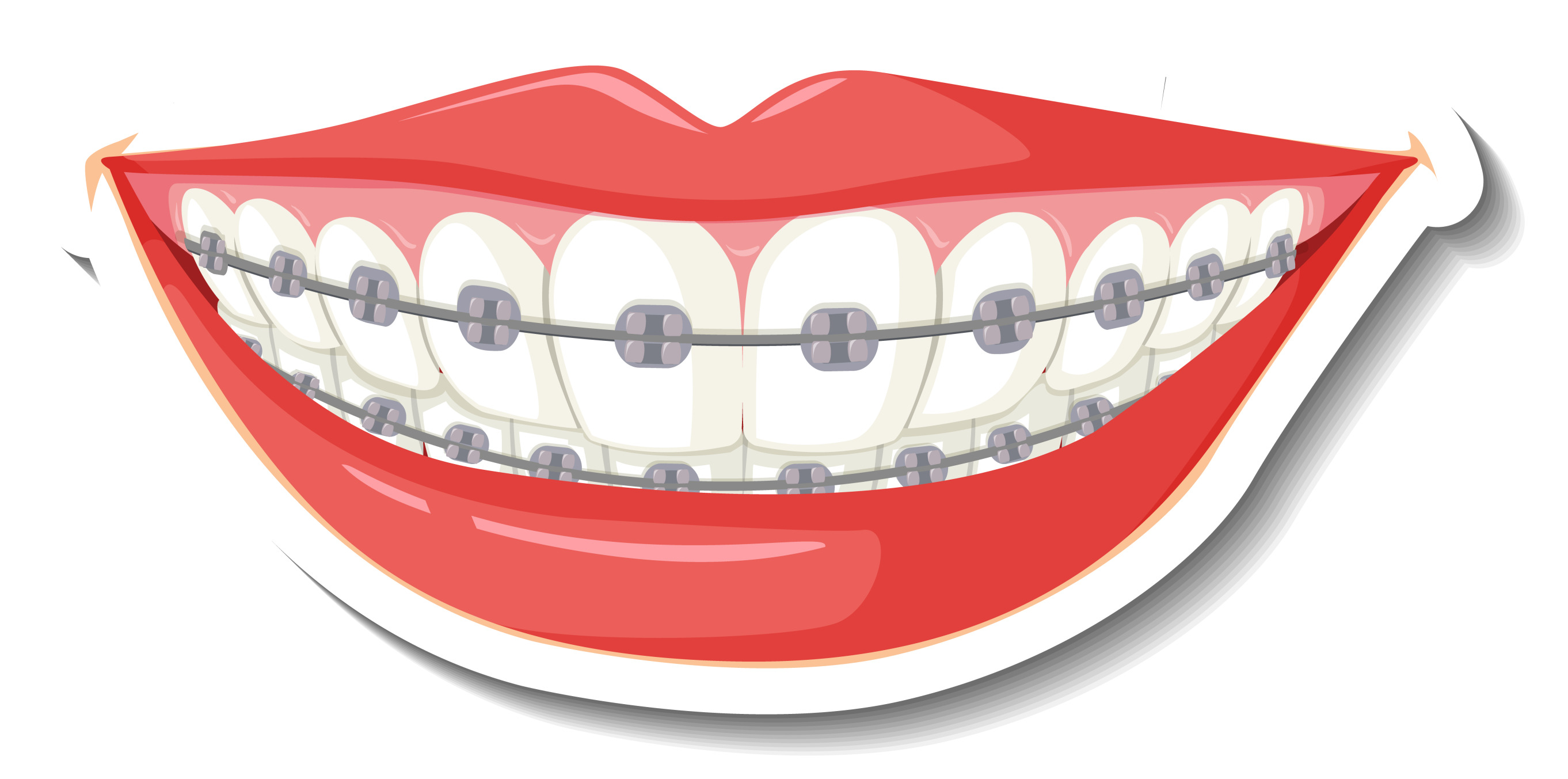 Smiling Braces Blank Meme Template
