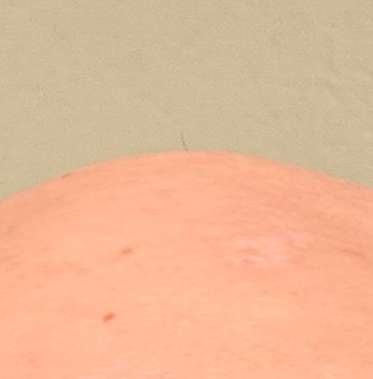 Bold head single hair Blank Meme Template
