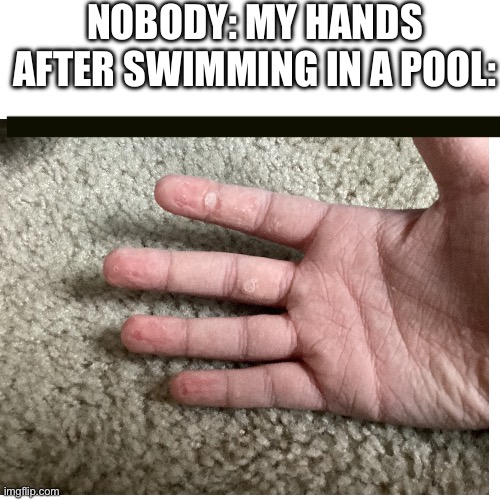 Nobody: my hands after swimming in a pool: | image tagged in skin | made w/ Imgflip meme maker