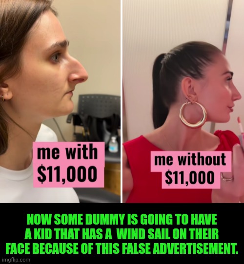 Funny | Now some dummy is going to have a kid that has a  wind sail on their face because of this false advertisement. | image tagged in funny,false advertising,plastic surgery,dating,women vs men,men vs women | made w/ Imgflip meme maker
