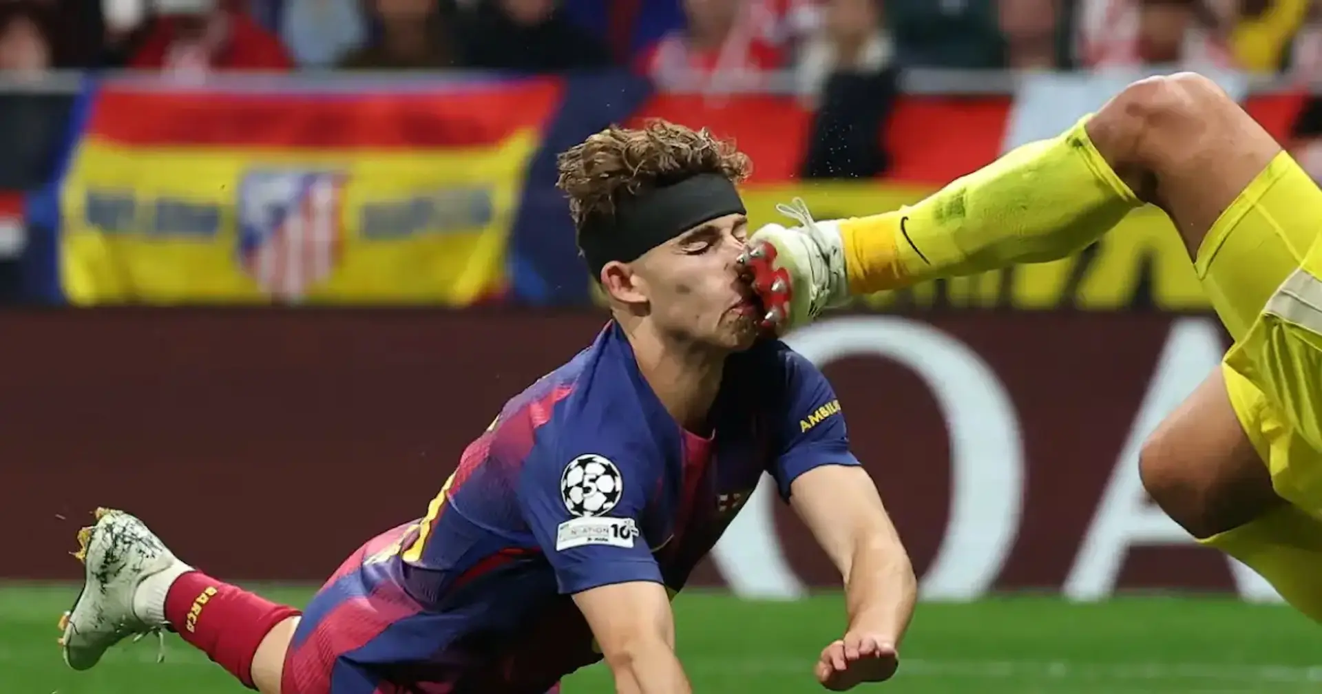 Fermin kicked face Blank Meme Template