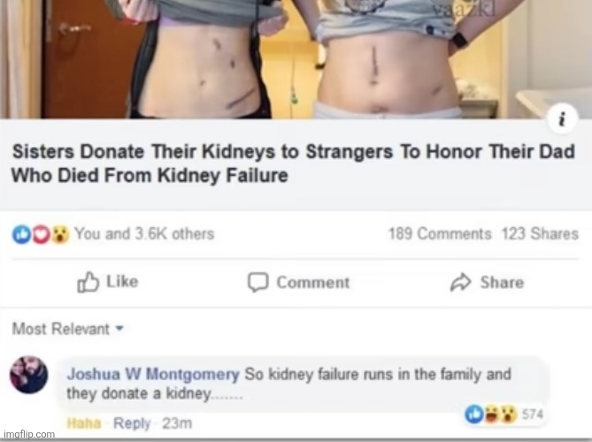 image tagged in memes,comments,uh oh,kidney,donor,organs | made w/ Imgflip meme maker