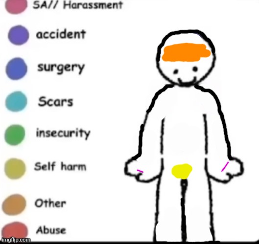 Other is acne, plus I have two small accidental cut scars, healing tho | image tagged in make your own,memes,beatingmyshi | made w/ Imgflip meme maker