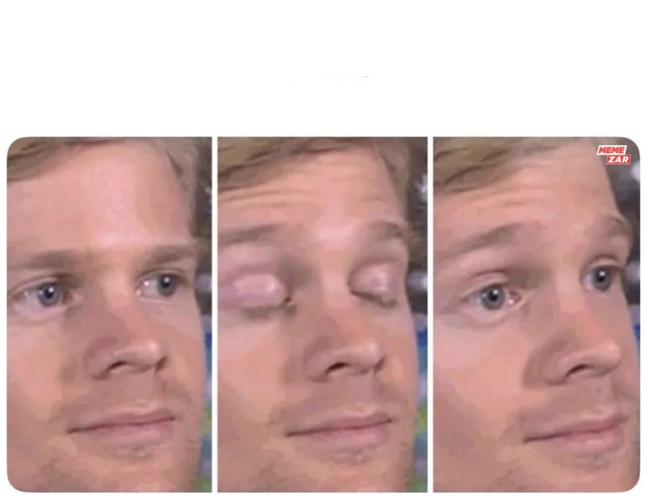 Blinking guy Blank Meme Template