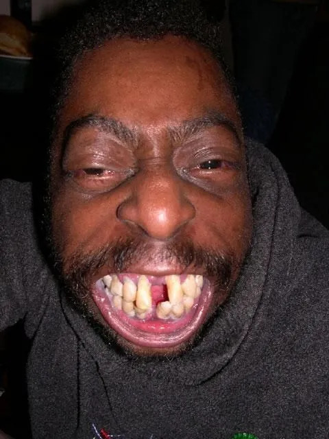 NO TEETH Blank Meme Template