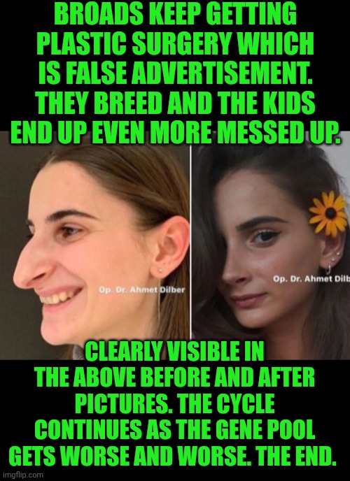 Funny | Broads keep getting plastic surgery which is false advertisement. They breed and the kids end up even more messed up. Clearly visible in the above before and after pictures. The cycle continues as the gene pool gets worse and worse. The end. | image tagged in funny,plastic surgery,dating,dating sucks,genetics,false advertising | made w/ Imgflip meme maker