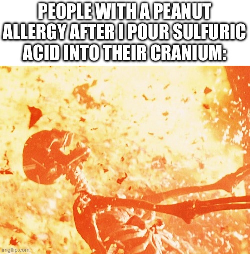 they’re so dramatic | People with a peanut allergy after I pour sulfuric acid into their cranium: | image tagged in fire skeleton,peanut,memes,funny | made w/ Imgflip meme maker