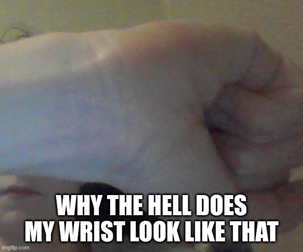 these aren't self harm scars, I do not know why these are here | why the hell does my wrist look like that | made w/ Imgflip meme maker