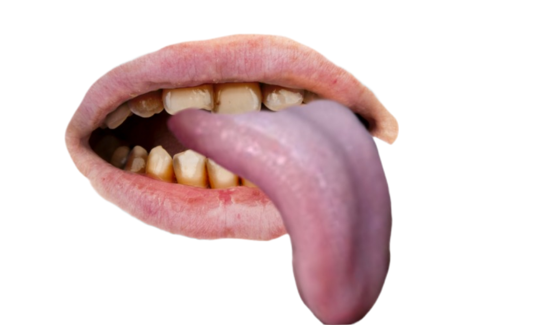 BSP png lips bad teeth tongue sticking out Blank Meme Template
