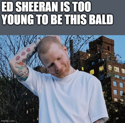 Ed Sheeran Shaved Head Meme | ed sheeran is too young to be this bald | image tagged in ed sheeran,shaved head,bald,head,funny,memes | made w/ Imgflip meme maker