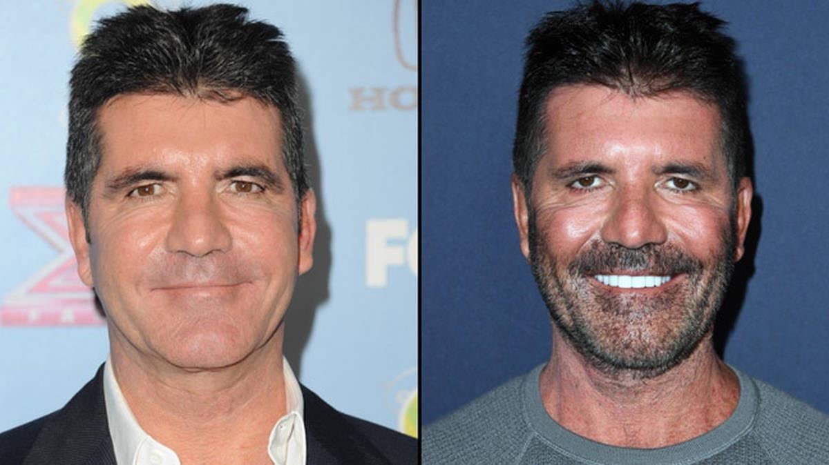 Cowell Surgery Blank Meme Template