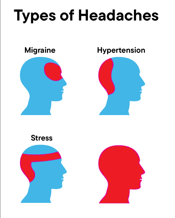 Types of Headaches Blank Meme Template