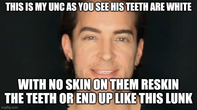 reskin                                                                                             the        teeth | this is my unc as you see his teeth are white; with no skin on them reskin the teeth or end up like this lunk | image tagged in brandon straka | made w/ Imgflip meme maker