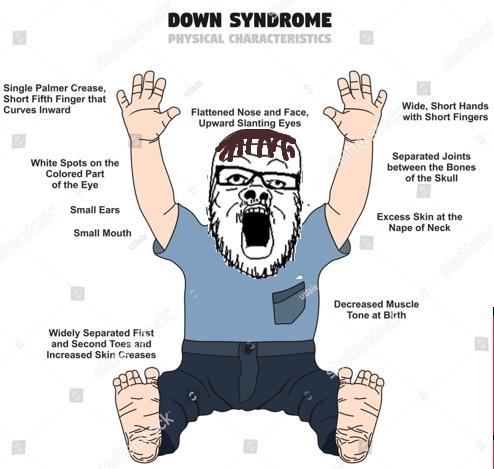 Down's Syndrome soyjak Blank Meme Template