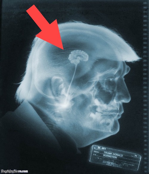 Trump brain moron Republican stupid x-ray JPP | image tagged in trump brain moron republican stupid x-ray jpp | made w/ Imgflip meme maker