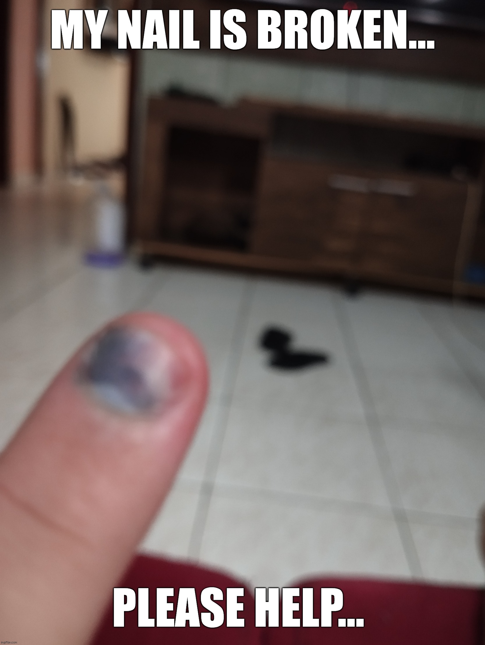 ?? | My nail is broken... Please help... | image tagged in broken,hurt,help,help me,nails | made w/ Imgflip meme maker