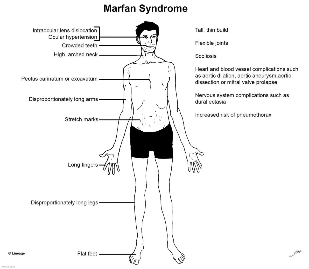 I uhhh gave him marfan syndrome is this allowed to post | image tagged in drawing,jim moriarty,marfan syndrome,bbc sherlock | made w/ Imgflip meme maker