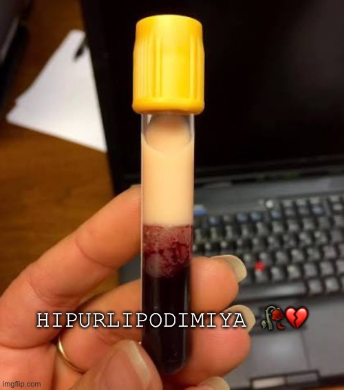 Hipurlipodimiya 🥀💔 | image tagged in bruh | made w/ Imgflip meme maker