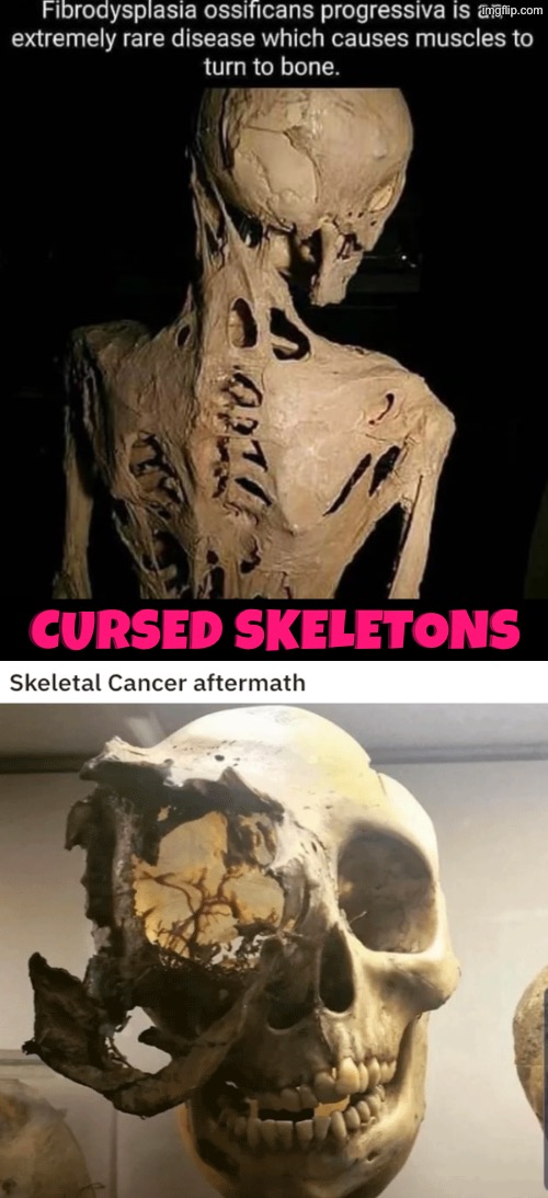 Cursed Skeletons | Cursed skeletons | image tagged in cursed images,skeletons,disease,unsee juice,what a terrible day to have eyes,drink bleach | made w/ Imgflip meme maker