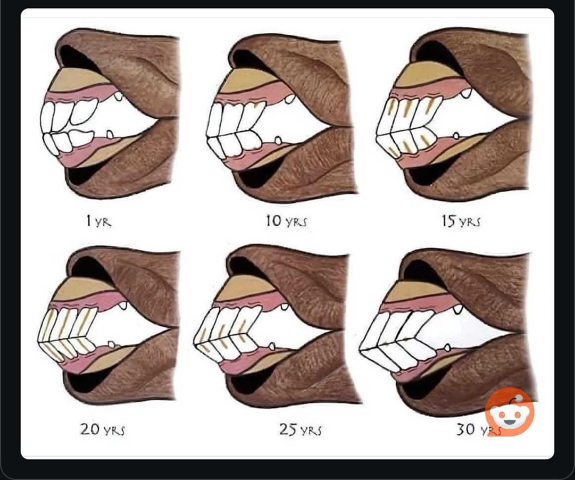 Horse Age Blank Meme Template