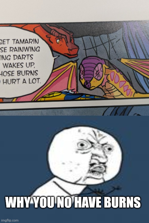 Where have the burns gone? | Why you no have burns | made w/ Imgflip meme maker