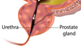 High Quality Prostate Gland Blank Meme Template