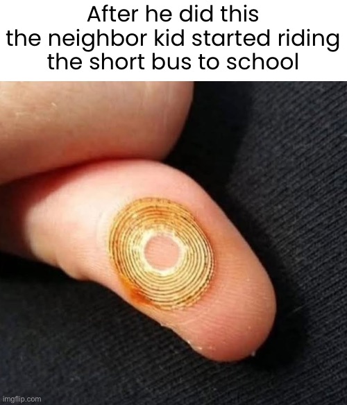 Special So Special | After he did this
the neighbor kid started riding
the short bus to school | image tagged in funny memes,gen x,cigarette lighter | made w/ Imgflip meme maker