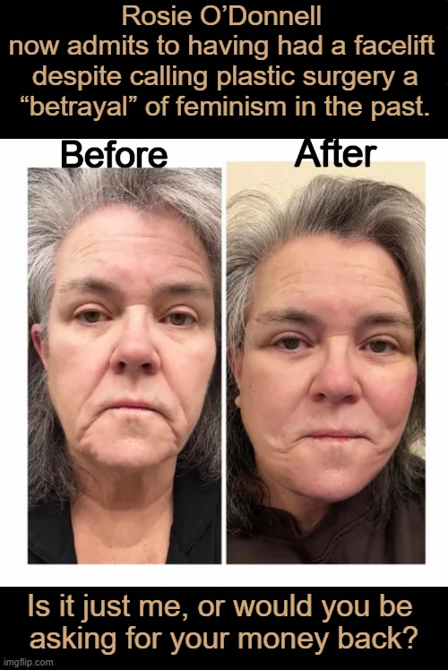Kinda Odd That Feminists Don't Look Too Feminine, But Male Feminists Do... | Rosie O’Donnell 
now admits to having had a facelift 
despite calling plastic surgery a
“betrayal” of feminism in the past. Before; After; Is it just me, or would you be 
asking for your money back? | image tagged in hmmm,rosie o'donnell,plastic surgery,feminism,betrayal,sjws | made w/ Imgflip meme maker
