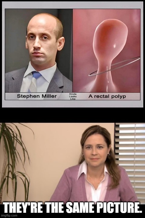 Stephen Miller Rectal Polyp | They're the same picture. | image tagged in they're the same picture | made w/ Imgflip meme maker