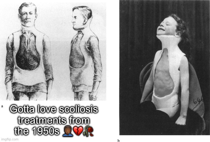 Gotta love scoliosis treatments from the 1950s 🤦🏾‍♂️💔🥀 | image tagged in sigh,memes,wtf,1950s | made w/ Imgflip meme maker