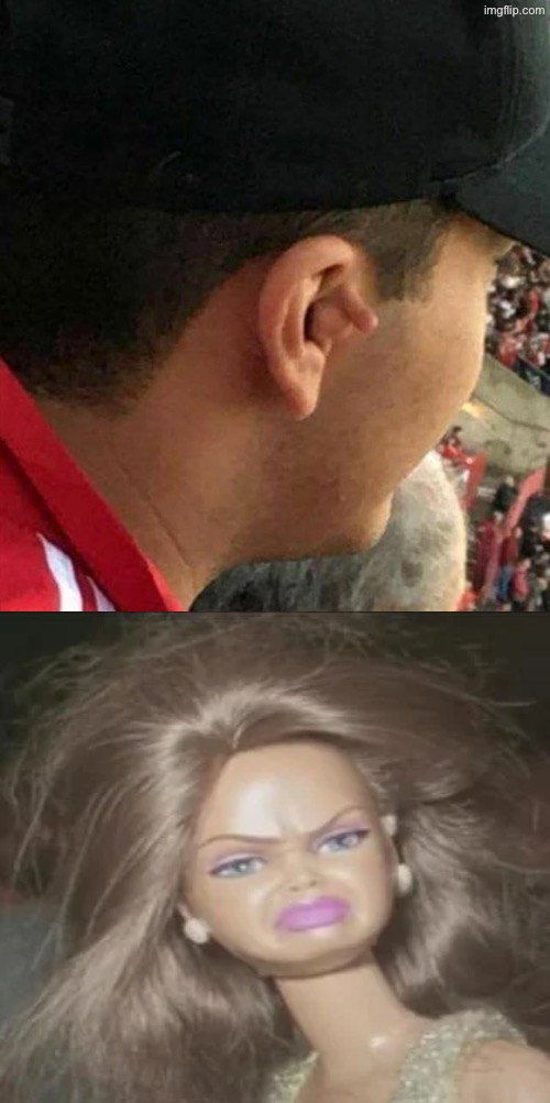 Uh I guess it's a thick skin tag that resembles something else | image tagged in beyond cursed,cursed images,what did i just see,what a terrible day to have eyes,dafuq,reactions | made w/ Imgflip meme maker