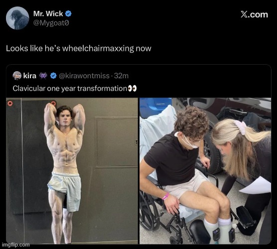 image tagged in looksmaxxing,wheelchair,god damn | made w/ Imgflip meme maker