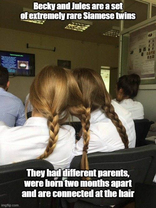 Siamese Twins | Becky and Jules are a set of extremely rare Siamese twins; They had different parents, were born two months apart and are connected at the hair | image tagged in siamese,twins,hair,miracle | made w/ Imgflip meme maker