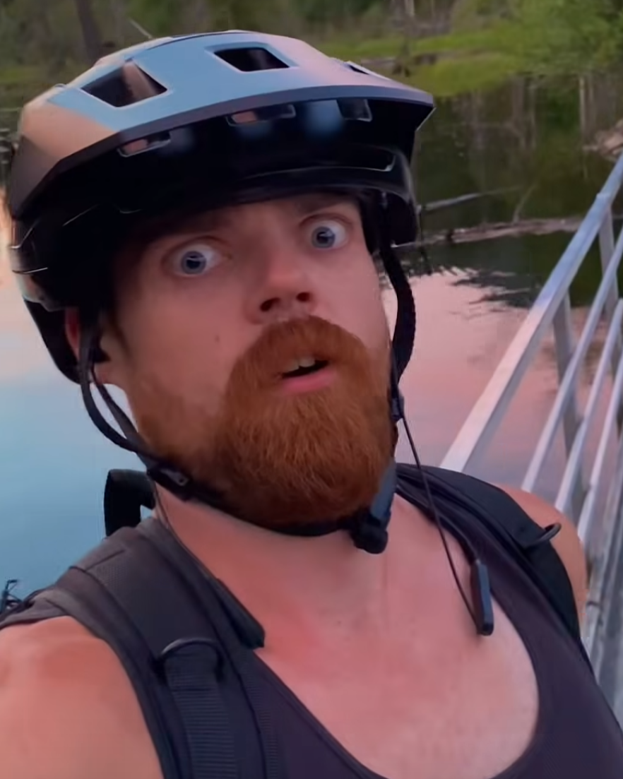 Wide-eyed and surprised Blank Meme Template