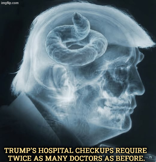 X-ray of Trump's brain, if any. Suspicious brown matter found. | Trump's hospital checkups require 
twice as many doctors as before. | image tagged in x-ray of trump's brain if any suspicious brown matter found,trump,health,check,hospital,doctors | made w/ Imgflip meme maker