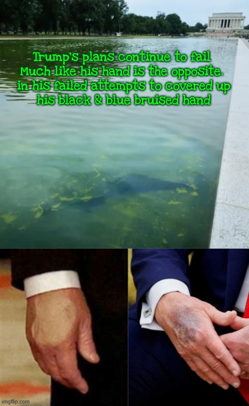 Red White and Bruised | Trump's plans continue to fail 
﻿Much like his hand is the opposite. 
﻿in his failed attempts to covered up
﻿his black & blue bruised hand | image tagged in algae is outsmarting trump,the blue green lagoon,trump's behind the 8 ball in pool,red white and bruised | made w/ Imgflip meme maker