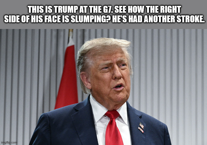 This is trump at the G7. See how the right side of his face is slumping? He's had another stroke. | made w/ Imgflip meme maker