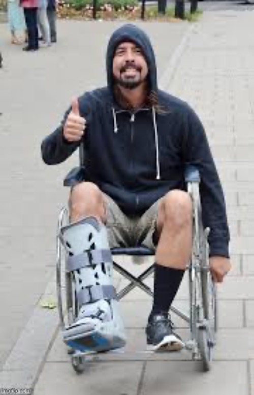 broken leg | image tagged in broken leg | made w/ Imgflip meme maker
