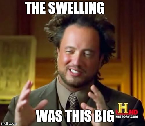 Ancient Aliens Meme | THE SWELLING WAS THIS BIG | image tagged in memes,ancient aliens | made w/ Imgflip meme maker