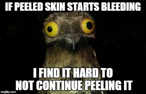 Weird Stuff I Do Potoo Meme | IF PEELED SKIN STARTS BLEEDING I FIND IT HARD TO NOT CONTINUE PEELING IT | image tagged in memes,weird stuff i do potoo | made w/ Imgflip meme maker