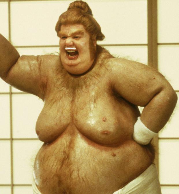 High Quality got moobs man boobs by consuming dairy Gynecomastia Blank Meme Template