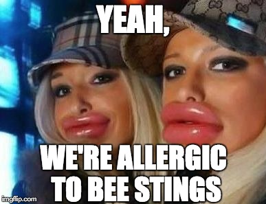 Stung right on the lips | YEAH, WE'RE ALLERGIC TO BEE STINGS | image tagged in memes,duck face chicks,bees | made w/ Imgflip meme maker