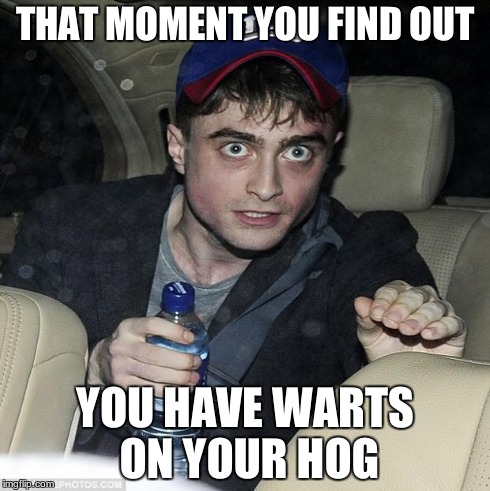 Hog-warts | THAT MOMENT YOU FIND OUT YOU HAVE WARTS ON YOUR HOG | image tagged in harry potter crazy,that moment when | made w/ Imgflip meme maker