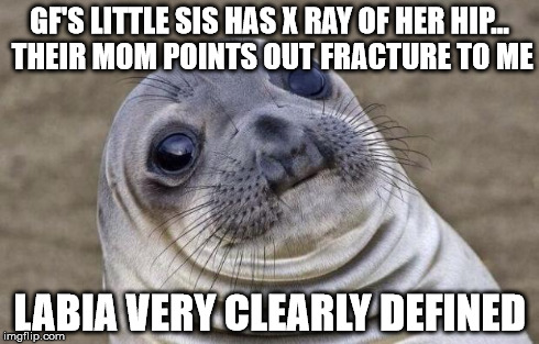 Awkward Moment Sealion Meme | GF'S LITTLE SIS HAS X RAY OF HER HIP... THEIR MOM POINTS OUT FRACTURE TO ME LABIA VERY CLEARLY DEFINED | image tagged in memes,awkward moment sealion,AdviceAnimals | made w/ Imgflip meme maker