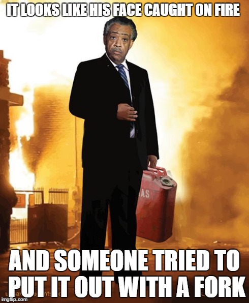 al sharpton | IT LOOKS LIKE HIS FACE CAUGHT ON FIRE AND SOMEONE TRIED TO PUT IT OUT WITH A FORK | image tagged in al sharpton | made w/ Imgflip meme maker