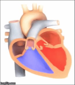 Esteosis mitral  | image tagged in gifs,estenosismitral,medicina | made w/ Imgflip video-to-gif maker