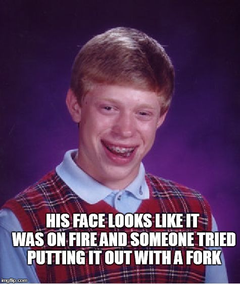 Bad Luck Brian Meme | HIS FACE LOOKS LIKE IT WAS ON FIRE AND SOMEONE TRIED PUTTING IT OUT WITH A FORK | image tagged in memes,bad luck brian | made w/ Imgflip meme maker